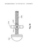 GASTRIC DEVICES, SYSTEMS, AND METHODS diagram and image