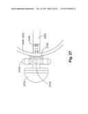 GASTRIC DEVICES, SYSTEMS, AND METHODS diagram and image