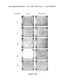 LOWER DOSAGE STRENGTH IMIQUIMOD FORMULATIONS AND SHORT DOSING REGIMENS FOR     TREATING GENITAL AND PERIANAL WARTS diagram and image