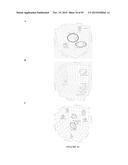 COMPOSITIONS AND METHODS FOR TREATING RETINAL DISEASES diagram and image