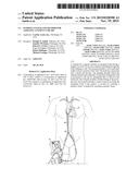 Pumping System and Method for Assisting a Patient s Heart diagram and image