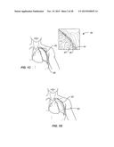 STEERABLE DEVICE FOR ACCESSING A TARGET SITE AND METHODS diagram and image