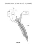 STEERABLE DEVICE FOR ACCESSING A TARGET SITE AND METHODS diagram and image