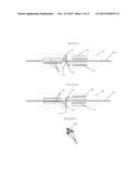 GUIDEWIRE MANIPULATION DEVICE diagram and image