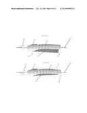 GUIDEWIRE MANIPULATION DEVICE diagram and image