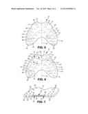 Adaptive Mouth Guard and Method of Use diagram and image