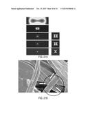 Micro Blood Vessels and Tissue Ducts diagram and image