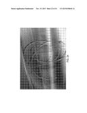 Micro Blood Vessels and Tissue Ducts diagram and image