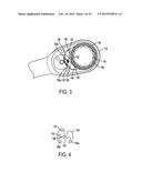 BIAS MEMBER FOR REDUCING RATCHETING ARC diagram and image