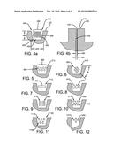 Sipe Reinforcement diagram and image