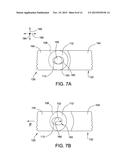 Elliptical Bore Pin Retention System diagram and image