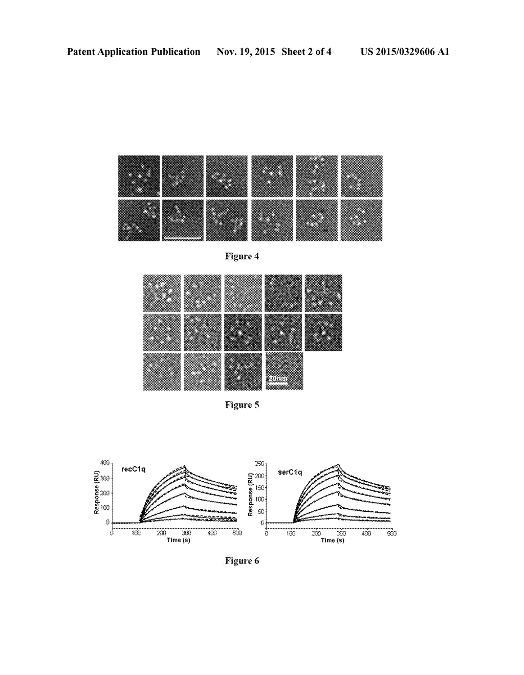 METHOD FOR PREPARING C1Q RECOMBINANT PROTEIN - diagram, schematic, and image 03