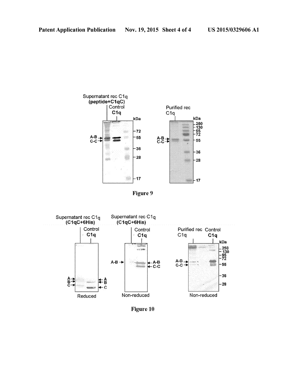 METHOD FOR PREPARING C1Q RECOMBINANT PROTEIN - diagram, schematic, and image 05