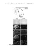 Identification of a 5-Gene Expression Signature Predicting Clinical     Outcome of Patients with Brain Tumors diagram and image