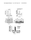 JAGGED1 AS A MARKER AND THERAPEUTIC TARGET FOR BREAST CANCER BONE     METASTASIS diagram and image