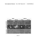 JAGGED1 AS A MARKER AND THERAPEUTIC TARGET FOR BREAST CANCER BONE     METASTASIS diagram and image