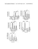 JAGGED1 AS A MARKER AND THERAPEUTIC TARGET FOR BREAST CANCER BONE     METASTASIS diagram and image