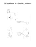 Casement Window Opening Device diagram and image