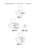 Enhanced Backup Ring Edge Features for Metal Face Seal in Roller Cone     Drill Bits diagram and image