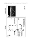 INERTIAL DEVICE, METHOD, AND PROGRAM diagram and image