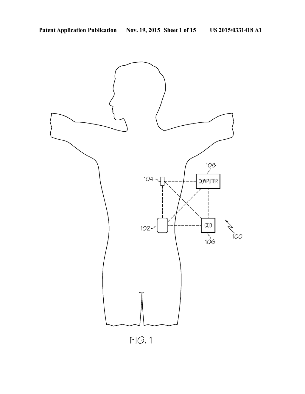 CALIBRATION FACTOR ADJUSTMENTS FOR INFUSION DEVICES AND RELATED METHODS     AND SYSTEMS - diagram, schematic, and image 02