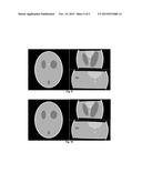 Spiral CT Systems and Reconstruction Methods diagram and image