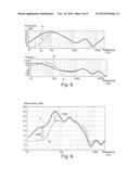 ANC NOISE ACTIVE CONTROL AUDIO HEADSET WITH PREVENTION OF THE EFFECTS OF A     SATURATION OF THE FEEDBACK MICROPHONE SIGNAL diagram and image