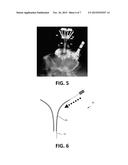 Hyperdrive and Neuroprobes for Stimulation Purposes diagram and image