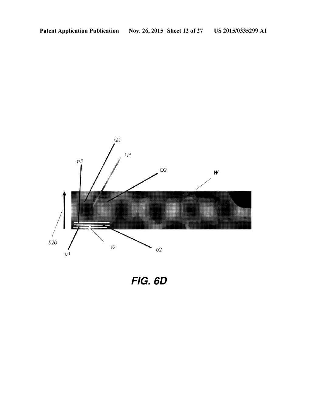 METHOD FOR TEETH SEGMENTATION AND ALIGNMENT DETECTION IN CBCT VOLUME - diagram, schematic, and image 13