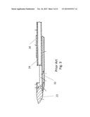 Biopsy With Marker Device and Method diagram and image