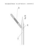 Biopsy With Marker Device and Method diagram and image