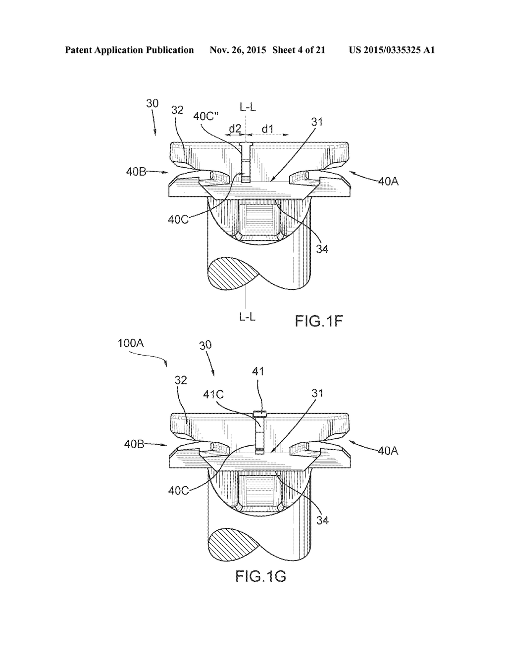 Devices And Methods for Advancing Knots - diagram, schematic, and image 05