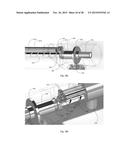 MINIMALLY INVASIVE LAPAROSCOPIC TISSUE REMOVAL DEVICE diagram and image