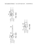 TISSUE RESECTION AND TREATMENT WITH SHEDDING PULSES diagram and image