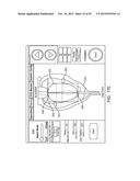 TISSUE RESECTION AND TREATMENT WITH SHEDDING PULSES diagram and image