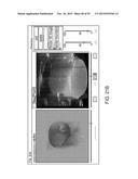 TISSUE RESECTION AND TREATMENT WITH SHEDDING PULSES diagram and image