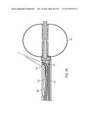 TISSUE RESECTION AND TREATMENT WITH SHEDDING PULSES diagram and image