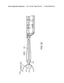 TISSUE RESECTION AND TREATMENT WITH SHEDDING PULSES diagram and image