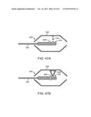 TISSUE RESECTION AND TREATMENT WITH SHEDDING PULSES diagram and image