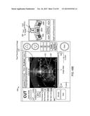 TISSUE RESECTION AND TREATMENT WITH SHEDDING PULSES diagram and image