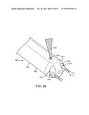 TISSUE RESECTION AND TREATMENT WITH SHEDDING PULSES diagram and image