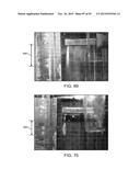 TISSUE RESECTION AND TREATMENT WITH SHEDDING PULSES diagram and image