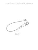 TISSUE RESECTION AND TREATMENT WITH SHEDDING PULSES diagram and image