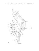 ORTHOPEDIC BONE PLATE AND LOCKING TAB APPARATUS AND METHOD OF USE diagram and image