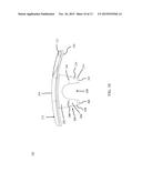 ORTHOPEDIC BONE PLATE AND LOCKING TAB APPARATUS AND METHOD OF USE diagram and image