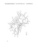 ORTHOPEDIC BONE PLATE AND LOCKING TAB APPARATUS AND METHOD OF USE diagram and image