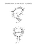 Methods And Devices For Treating Pelvic Conditions diagram and image