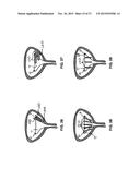 Methods And Devices For Treating Pelvic Conditions diagram and image