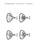 Methods And Devices For Treating Pelvic Conditions diagram and image