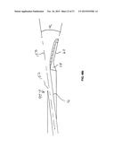 Methods And Devices For Treating Pelvic Conditions diagram and image